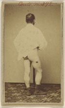 Jno. Hamilton. Civil War victim; Attributed to William H. Bell, American, 1830 - 1910, about 1865; Albumen silver print