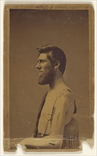 Civil War victim in profile, seated; Attributed to William H. Bell, American, 1830 - 1910, about 1864; Albumen silver print