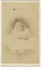 baby, 3 month old - August 1887; Thomas Barns; August 1887; Albumen silver print