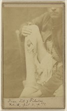 Frank S. Hardy Civil War victim; Attributed to William H. Bell, American, 1830 - 1910, October 30, 1864; Albumen silver print
