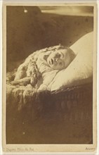 child with head turned to the camera, in bassinet; J. Dupont, Belgian, 1818 - 1901, about 1865; Albumen silver print