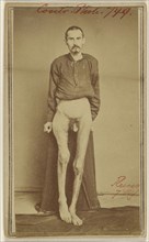 Geo. Ruass Civil War victim; Attributed to William H. Bell, American, 1830 - 1910, about 1864; Albumen silver print