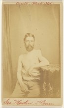 Geo. Martin, 5th Conn. Civil War victim; S. Friedlaender, American, active 1860s, 1864 - 1866; Albumen silver print