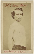 John Brink, K, 11th Pa. Cav. Civil War victim; American; 1864 - 1865; Albumen silver print