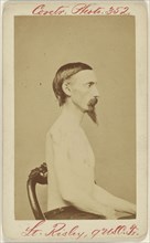 Lt. D.G. Risley q USC. Tr. Civil War victim; American; 1862 - 1864; Albumen silver print