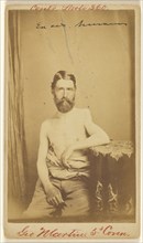 Geo. Martin, 5d Conn. Civil War victim; S. Friedlaender, American, active 1860s, 1864 - 1866; Albumen silver print