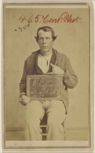 R. Giffin, M 14th N.T.H.A. 20175 D., Civil War victim; American; 1865 - 1870; Albumen silver print