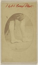 W.H. Gaylord, Sgt. B, 7th U.S. Col. Art., Civil War victim; American; 1880 - 1881; Albumen silver print
