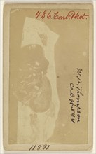 William A. Thompson Co. B. 95 NYV. Civil War victim; Reed Brockway Bontecau, American, 1824 - 1907, 1864 - 1870; Albumen silver