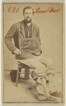 E.R. Niles, E. 100th Pa. 20004. Civil War victim; American; 1862 - 1864; Albumen silver print