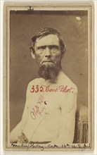 Martin Kelley, Civil War victim; Attributed to William H. Bell, American, 1830 - 1910, 1862-1870; Albumen silver print