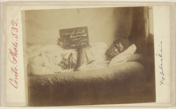 Edward Scott, Civil War victim; American; 1862-1870; Albumen silver print