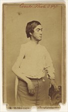Russell B. Mason, Civil War victim; Baldwin & Prior, American, 1865 - 1867, about 1864; Albumen silver print