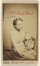 John Kluff, Civil War victim; H. Hirschinger, American, active New York, New York 1860s, 1864 - 1865; Albumen silver print