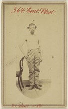 George T. Abbot, False joint of the humerus after a G.S. Fracture - Civil War victim; American; about 1864; Albumen silver print