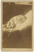 Paul 10 moins baby in a crib looking up out; J. Dupont, Belgian, 1818 - 1901, about 1870; Albumen silver print