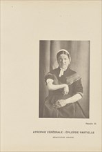 Cerebral Atrophy: Partial Epilepsy Right Hemiplegia; Paul-Marie-Léon Regnard, French, 1850 - 1927, Paris, France; 1878