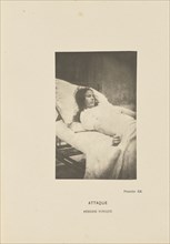 Attaque Période Tonique; Paul-Marie-Léon Regnard, French, 1850 - 1927, Paris, France; 1878; Photogravure; 10.5 × 6.7 cm