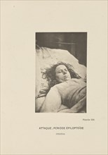 Attaque; Période Épileptoïde Stertor; Paul-Marie-Léon Regnard, French, 1850 - 1927, Paris, France; 1878; Photogravure