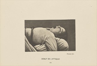 Début de l'Attaque Cri; Paul-Marie-Léon Regnard, French, 1850 - 1927, Paris, France; 1878; Photogravure; 6.5 × 10.5 cm