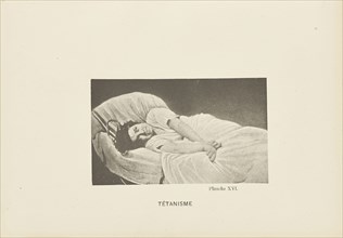 Tétanisme; Paul-Marie-Léon Regnard, French, 1850 - 1927, Paris, France; 1878; Photogravure; 6.4 × 10.6 cm 2 1,2 × 4 3,16 in