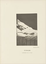 Tétanisme Attitude de la Face; Paul-Marie-Léon Regnard, French, 1850 - 1927, Paris, France; 1878; Photogravure; 10 × 6.5 cm