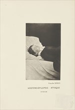 Hystéro-Épilepsie: Attaque Stertor; Paul-Marie-Léon Regnard, French, 1850 - 1927, Paris, France; 1878; Photogravure
