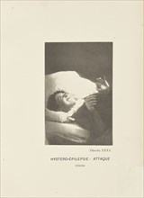 Hystéro-Épilepsie: Attaque Délire; Paul-Marie-Léon Regnard, French, 1850 - 1927, Paris, France; 1878; Photogravure