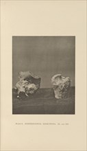 Subpereosteal Resections; Charles B. Brigham, American, 1845 - 1903, Cambridge, Massachusetts, United States; 1876; Heliotype