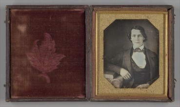 Untitled, 1839/99, Possibly William J. Shew, American, 1820–1903, United States, Daguerreotype, 8.1