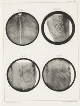 Four longitudinal and transverse sections of a human medulla oblongata, page, photomechanical