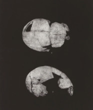 CRÂNE HUMAIN. 1. SINCIPUT, 2. PROFIL 1, 2 nature, Two views of a human skull, top view and en