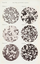 Six enlargements of blood cells, page, photomechanical print, number: 'Pl. II.', number: 'Photo. 1
