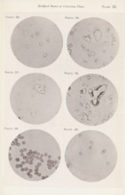 Six enlargements of colorless blood corpuscles, page, photomechanical print, number: 'Pl. XI.',