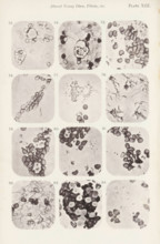 Twelve enlargements of blood corpuscles, page, photomechanical print, number: 'Pl. XIII.', number: