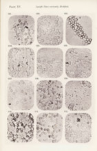 Twelve enlargements of lymphocytes, page, photomechanical print, number: 'Pl. XV.', number: 'Photo.