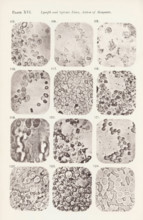 Twelve enlargements of the effects of saline solution on lymphocytes, page, photomechanical print,
