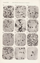 Twelve magnifications of blood corpuscles in a bone marrow, page, photomechanical print, number: