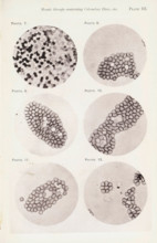 Six enlargements of blood cells, page, photomechanical print, number: 'Photo. 7., Photo. 12.',
