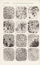 Twelve enlargements of bone marrow, page, photomechanical print, number: 'Pl. XXII.', number: