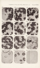 Eleven enlargements of blood cells and a micrometer enlargement, page, photomechanical print,