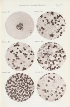 Six enlargements of blood cells, page, photomechanical print, number: 'Pl. V.', number: 'Photo. 19