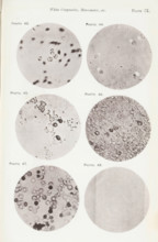 Five enlargements of blood and a micrometer, page, photomechanical print, number: 'Pl. IX.',