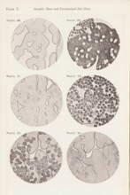Six enlargements of blood after various procedures, page, photomechanical print, number: 'Pl. X.',