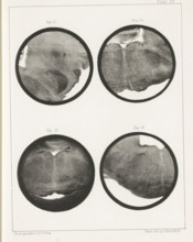 Four details of a sheep medulla oblongata, page, photomechanical print, number: 'Plate IV. Fig. 13.