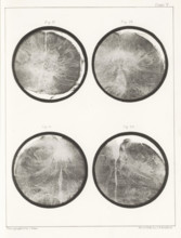Four details of a human medulla oblongata, page, photomechanical print, number: 'Plate V. Fig. 17.