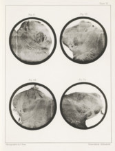 Four details of a human medulla oblongata, page, photomechanical print, number: 'Plate VI. Fig. 21.