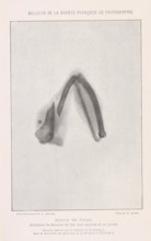 X-ray of a pheasant bone, Aileron de faison montrant la fracture de l'os, un esquille et un plomb,
