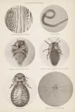 Overview of microscopic enlargements, page, photomechanical print, Top two hairworms, middle two