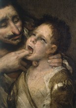 Goya, La toux (le Lazarillo de Tormes) - Détail